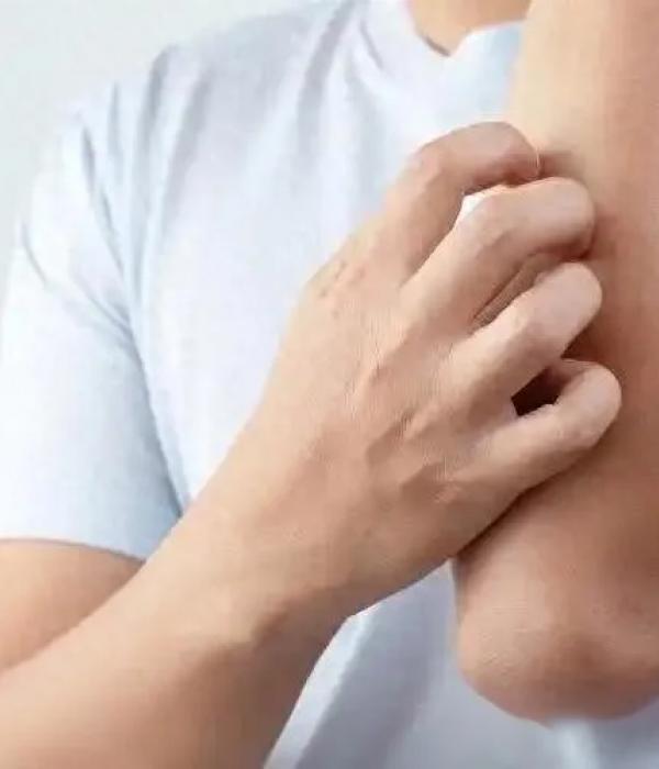 医生：肝硬化发出的第一个信号，通常在皮肤上，很多人都没放心上